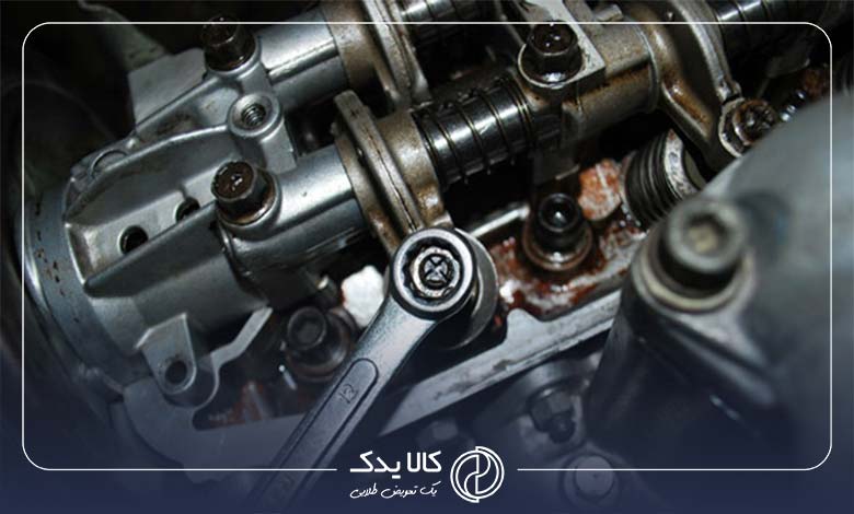 نحوه انجام فیلرگیری